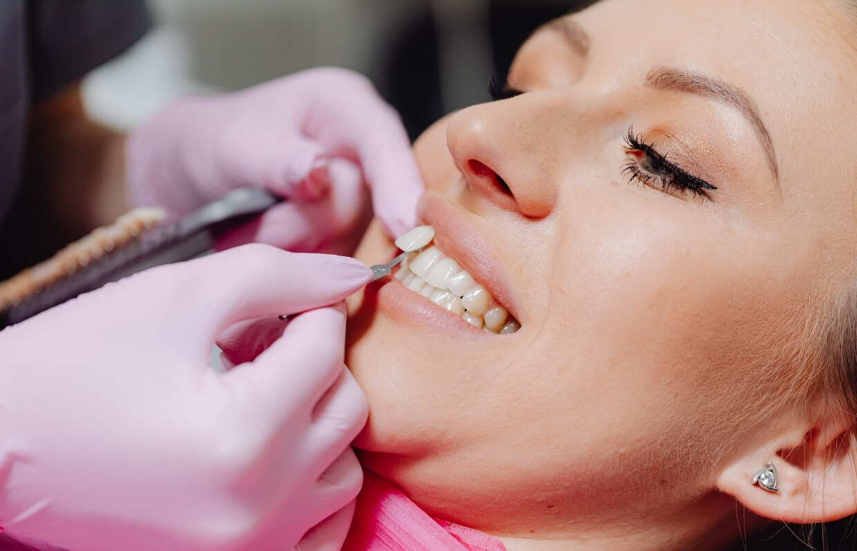 Cosmetic Crowns vs. Veneers: Which Should You Choose?