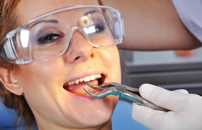 Emergency Tooth Extractions