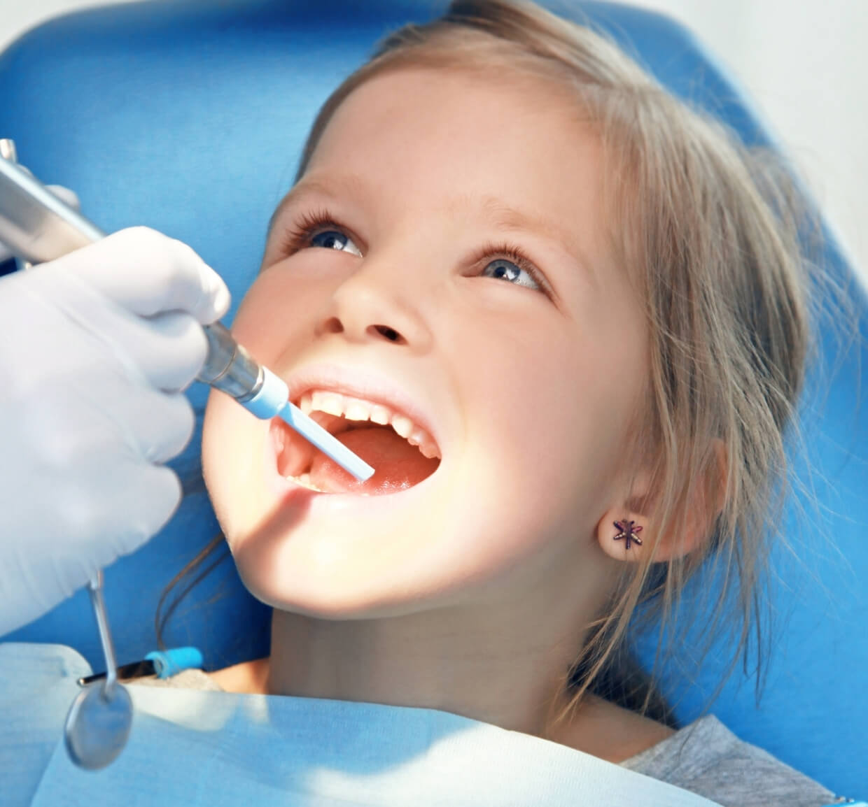 How Dental Sealants Work (Step-by-Step)