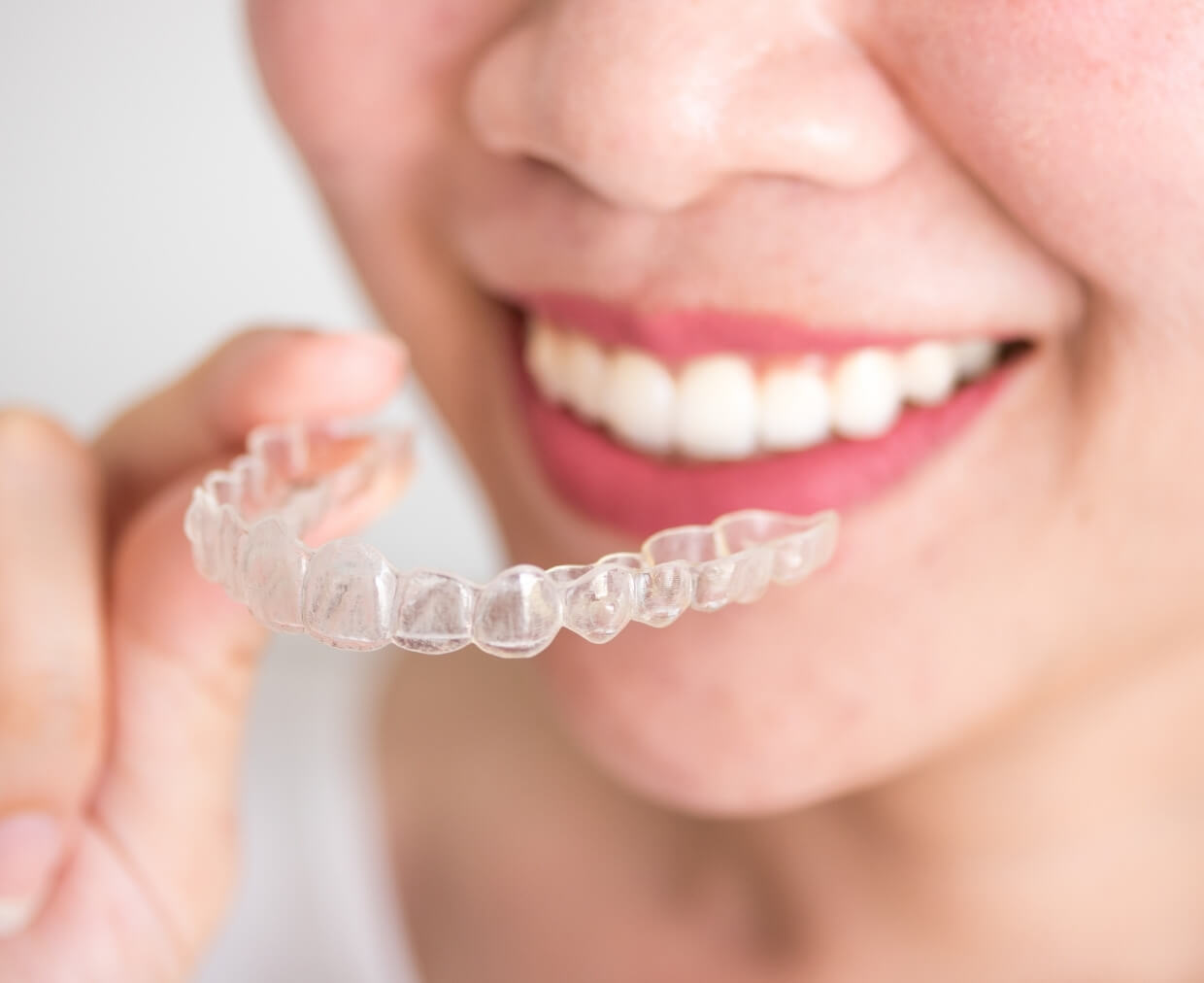 Our Invisalign for Adults Services