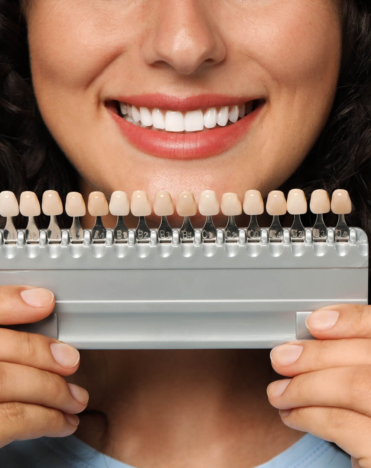 The Veneer Process at Kingsview Dental