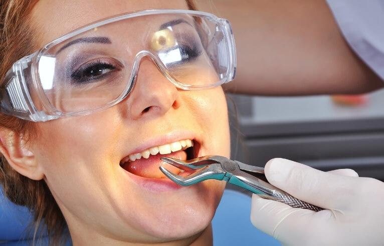 Tooth Extractions (Routine, Surgical & Wisdom Teeth)