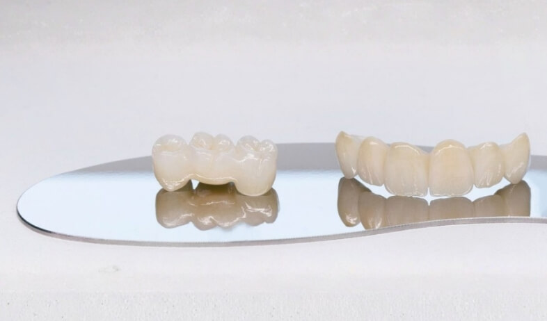 Types of Dental Bridges We Offer
