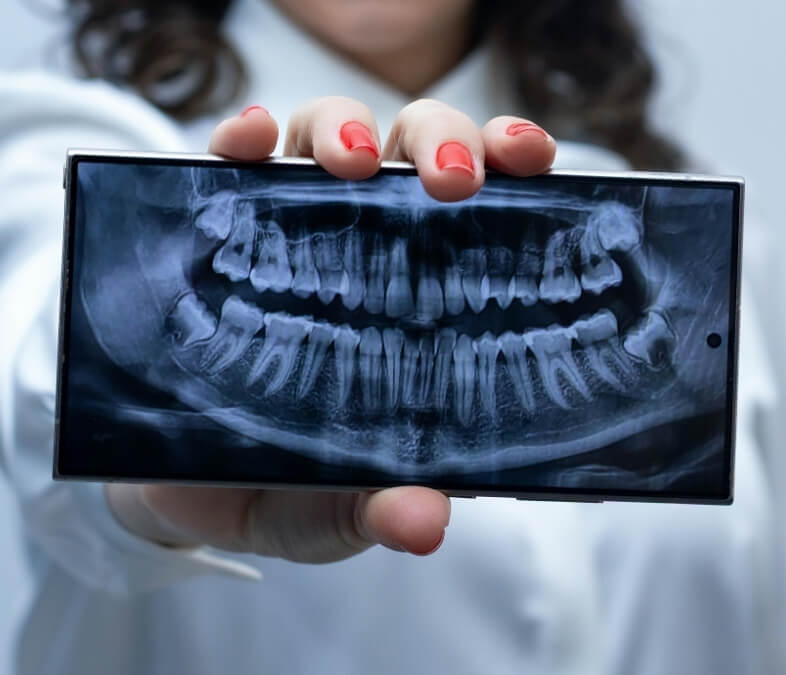 Types of Dental X-Rays We Use