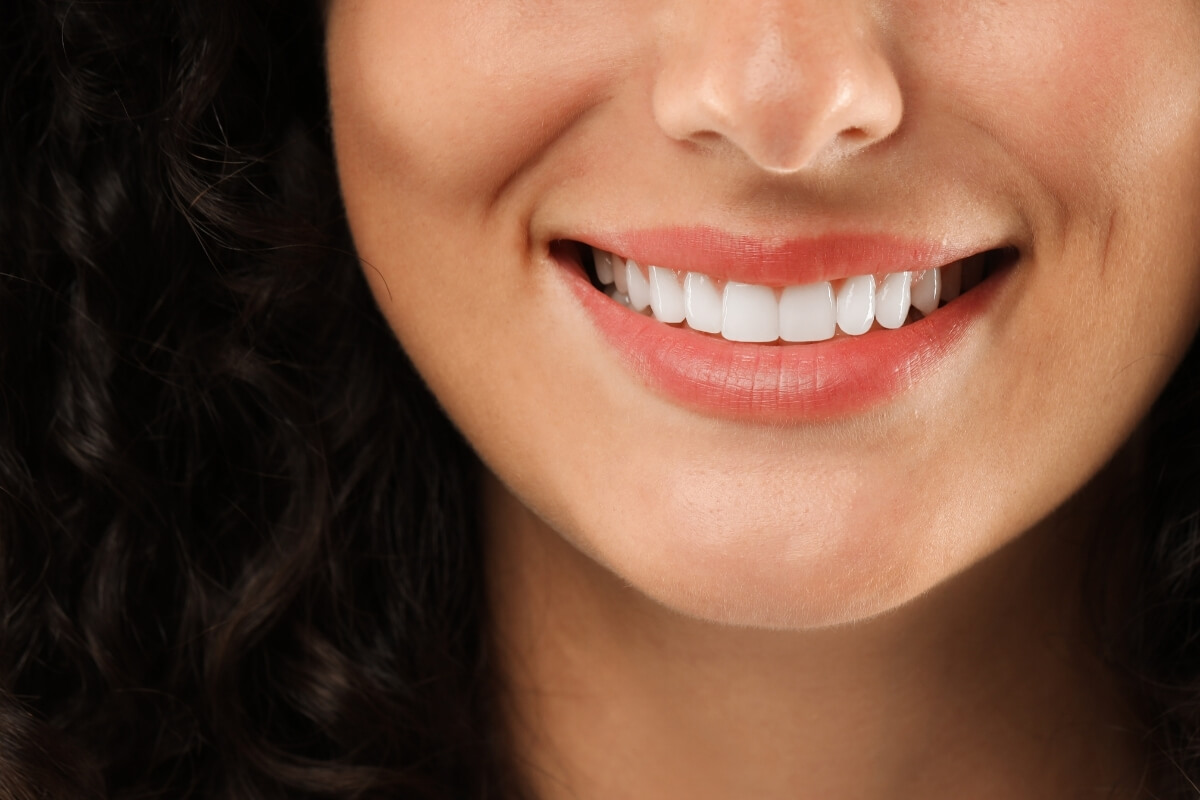 What to Expect After Multi-Tooth Implant Treatment