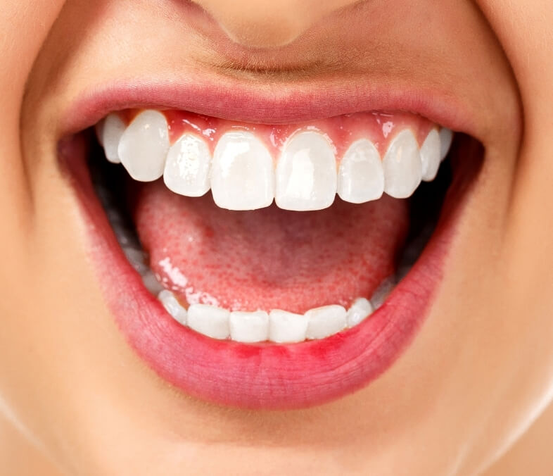 Who Needs Full-Mouth Reconstruction?