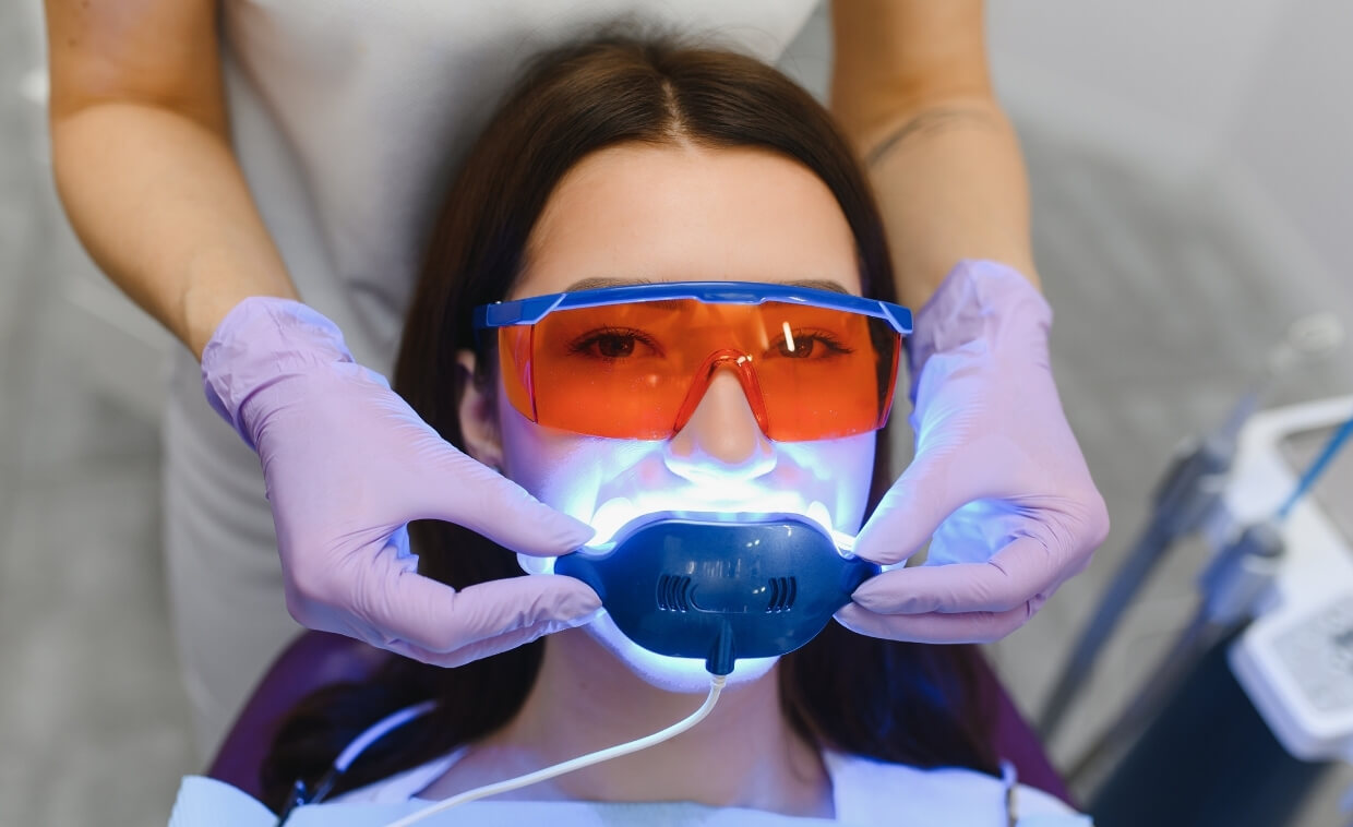 Why Choose Professional Whitening Instead of Drugstore Kits?